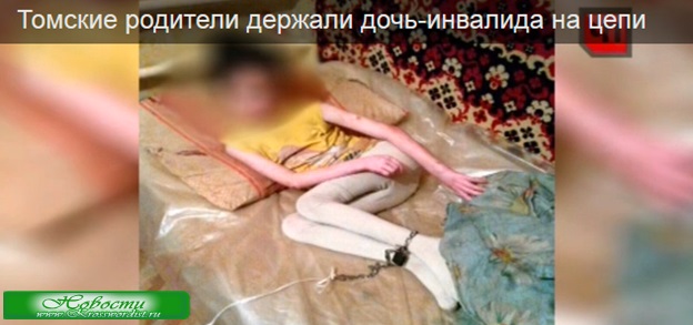 В Томске родители держали ребенка-инвалида на цепи